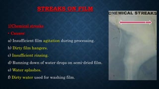 STREAKS ON FILM
1)Chemical streaks
• Causes:
a) Insufficient film agitation during processing.
b) Dirty film hangers.
c) Insufficient rinsing.
d) Running down of water drops on semi-dried film.
e) Water splashes.
f) Dirty water used for washing film.
 