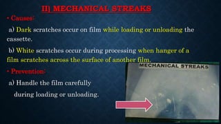 II) MECHANICAL STREAKS
• Causes:
a) Dark scratches occur on film while loading or unloading the
cassette.
b) White scratches occur during processing when hanger of a
film scratches across the surface of another film.
• Prevention:
a) Handle the film carefully
during loading or unloading.
 