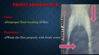 FROSTY AREAS ON FILM
• Cause :
a)Improper final washing of film.
• Prevention :
a)Wash the film properly with fresh water.
 