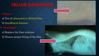 YELLOW RADIOGRAPH
• Causes:
a) Use of exhausted or diluted fixer.
b) Insufficient fixation.
• Prevention:
a) Replace the fixer solution.
b) Ensure proper fixing of the film.
 