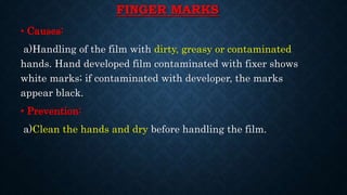 FINGER MARKS
• Causes:
a)Handling of the film with dirty, greasy or contaminated
hands. Hand developed film contaminated with fixer shows
white marks; if contaminated with developer, the marks
appear black.
• Prevention:
a)Clean the hands and dry before handling the film.
 