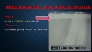 WHITE HORIZONTAL AREA ON TOP OF THE FILM
• Cause:
a)Low level of developer in tank.
• Prevention:
a)Maintain proper level of the developer.
 