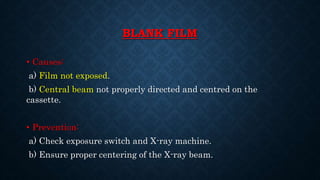 BLANK FILM
• Causes:
a) Film not exposed.
b) Central beam not properly directed and centred on the
cassette.
• Prevention:
a) Check exposure switch and X-ray machine.
b) Ensure proper centering of the X-ray beam.
 