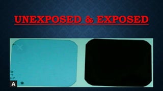 UNEXPOSED & EXPOSED
 