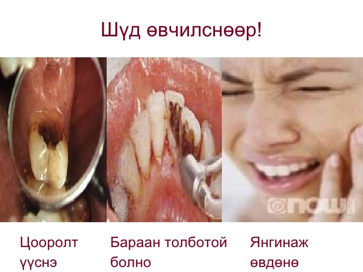 5 r angi.amnii hondiin eruul ahui.bolormaa