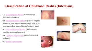 Pediatric Diffuse Rash 5-Rash-Like Illnesses in Children – Focus on Infectious Causes-1.pptx