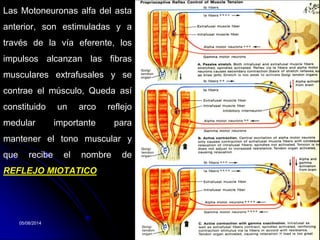 05/08/2014 Dr. Omar Diaz Tablas 44
Las Motoneuronas alfa del asta
anterior, son estimuladas y a
través de la vía eferente, los
impulsos alcanzan las fibras
musculares extrafusales y se
contrae el músculo, Queda así
constituido un arco reflejo
medular importante para
mantener el tono muscular y
que recibe el nombre de
REFLEJO MIOTATICO
 