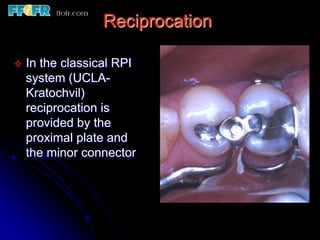 Reciprocation Rpi 5.retainers, clasp assemblies and indirect retainers | PPT