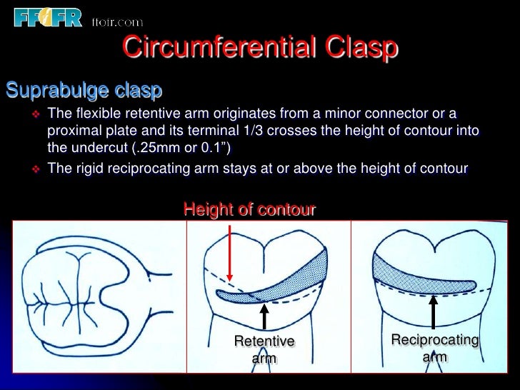 5.retainers, clasp assemblies and indirect retainers