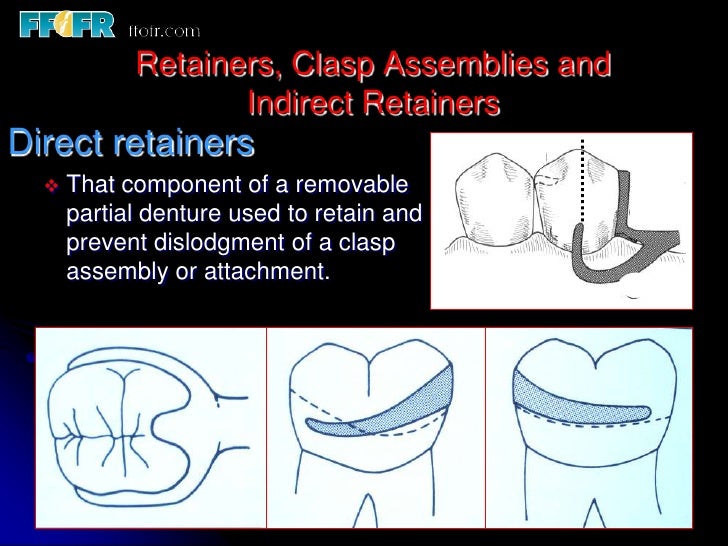 5.retainers, clasp assemblies and indirect retainers