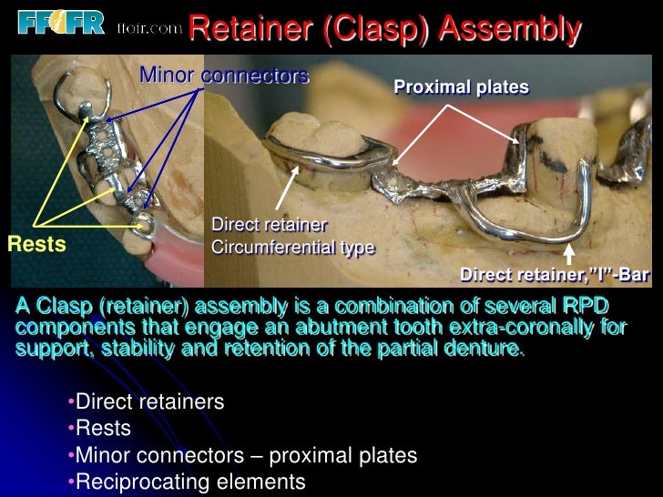 5.retainers, clasp assemblies and indirect retainers