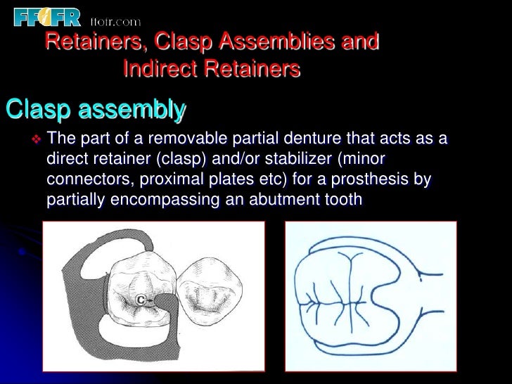 5.retainers, clasp assemblies and indirect retainers