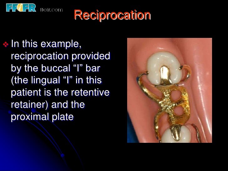 5.retainers, clasp assemblies and indirect retainers