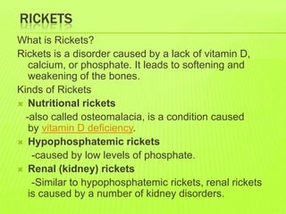 RICKETS
What is Rickets?
Rickets is a disorder caused by a lack of vitamin D,
   calcium, or phosphate. It leads to softening and
   weakening of the bones.
Kinds of Rickets
 Nutritional rickets
  -also called osteomalacia, is a condition caused
   by vitamin D deficiency.
 Hypophosphatemic rickets
    -caused by low levels of phosphate.
 Renal (kidney) rickets
    -Similar to hypophosphatemic rickets, renal rickets
   is caused by a number of kidney disorders.
 