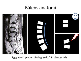 Bålens anatomiRyggraden i genomskärning, sedd från vänster sida