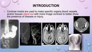 INTRODUCTION
Contrast media are used to make specific organs,blood vessels
and/or tissues stand out with more image contrast to better show
the presence of disease or injury.
 