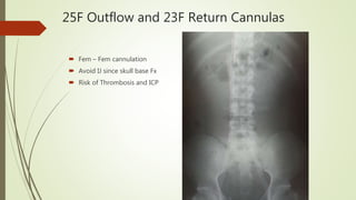 25F Outflow and 23F Return Cannulas
 Fem – Fem cannulation
 Avoid IJ since skull base Fx
 Risk of Thrombosis and ICP
 
