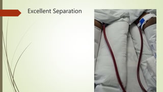 Excellent Separation
 