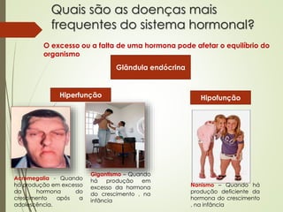 Quais são as doenças mais
frequentes do sistema hormonal?
O excesso ou a falta de uma hormona pode afetar o equilíbrio do
organismo
Glândula endócrina
Hiperfunção Hipofunção
Acromegalia - Quando
há produção em excesso
da hormona do
crescimento após a
adolescência.
Gigantismo – Quando
há produção em
excesso da hormona
do crescimento , na
infância
Nanismo – Quando há
produção deficiente da
hormona do crescimento
, na infância
 