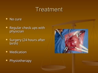 Treatment
Treatment
 No cure
No cure
 Regular check ups with
Regular check ups with
physician
physician
 Surgery (24 hours after
Surgery (24 hours after
birth)
birth)
 Medication
Medication
 Physiotherapy
Physiotherapy
 