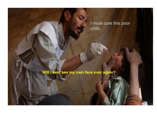 I must cure this poor child. Will I ever see my own face ever again? 