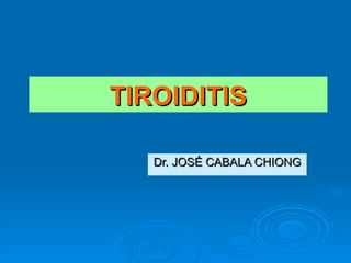 TIROIDITIS Dr. JOSÉ CABALA CHIONG 