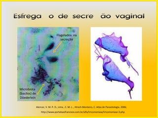 Esfregaço de secreção vaginal

                                    Flagelados na
                                       secreção




 Microbiota
 (bacilos) de
 Döederlein

                Alencar, V. M. P. D., Lima , C. M. L. , Hirsch-Monteiro, C. Atlas de Parasitologia. 2006;
                    http://www.portalsaofrancisco.com.br/alfa/tricomoniase/tricomoniase-3.php
 