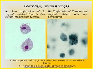 Forma(s) evolutiva(s)
A:   Two  trophozoites  of  T.               B:  Trophozoite  of  Trichomonas
vaginalis  obtained  from  in vitro          vaginalis  stained  with  iron 
culture, stained with Giemsa.                hematoxylin.




    A: Two trophozoites of T. vaginalis obtained from in vitro culture, stained with
                                            Giemsa.
            B: Trophozoite of T. vaginalis stained with iron hematoxylin.
                  http://www.dpd.cdc.gov/dpdx/HTML/ImageLibrary/Trichomoniasis_il.htm
 