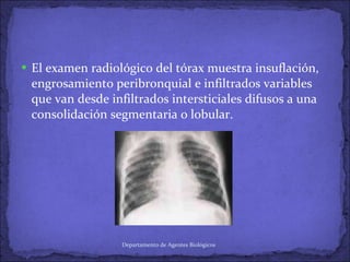 El examen radiológico del tórax muestra insuflación, engrosamiento peribronquial e infiltrados variables que van desde infiltrados intersticiales difusos a una consolidación segmentaria o lobular. Departamento de Agentes Biológicos 