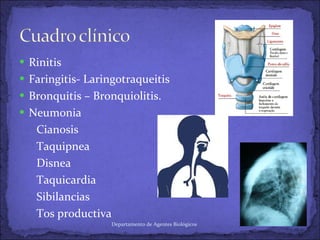 Rinitis Faringitis- Laringotraqueitis Bronquitis – Bronquiolitis. Neumonia Cianosis Taquipnea  Disnea Taquicardia Sibilancias Tos productiva Departamento de Agentes Biológicos 