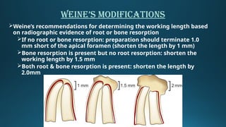 5- working lengthwerthjkhgtrewerfghdfg.pptx