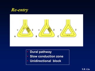 Re-entry




       • Dural pathway
       • Slow conduction zone
       • Unidirectional block

                                Y.B. Liu
 