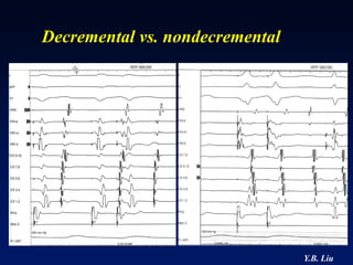Decremental vs. nondecremental




                                 Y.B. Liu
 