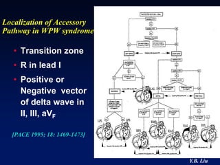 Localization of Accessory
Pathway in WPW syndrome

   • Transition zone
   • R in lead I
   • Positive or
     Negative vector
     of delta wave in
     II, III, aVF

  [PACE 1995; 18: 1469-1473]



                               Y.B. Liu
 
