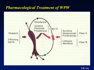 Pharmacological Treatment of WPW




                                   Y.B. Liu
 