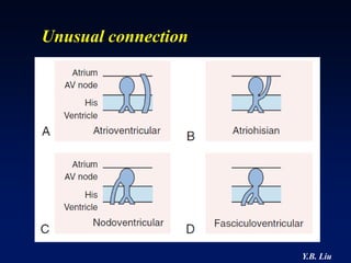 Unusual connection




                     Y.B. Liu
 