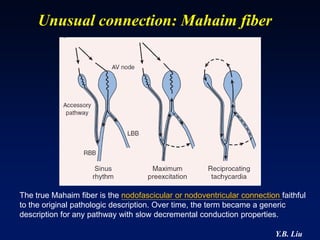 Unusual connection: Mahaim fiber




The true Mahaim fiber is the nodofascicular or nodoventricular connection faithful
to the original pathologic description. Over time, the term became a generic
description for any pathway with slow decremental conduction properties.

                                                                         Y.B. Liu
 