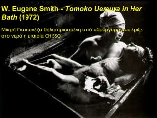 W. Eugene Smith -  Tomoko Uemura in Her Bath  (1972) Μικρή Γιαπωνέζα δηλητηριασμένη από υδράργυρο   που έριξε στο νερό η εταιρία  CHISSO 
