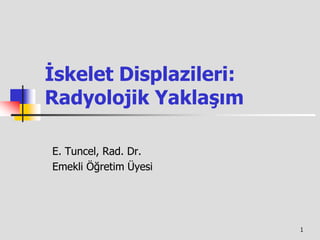 İskelet Displazileri:
Radyolojik Yaklaşım

E. Tuncel, Rad. Dr.
Emekli Öğretim Üyesi




                        1
 