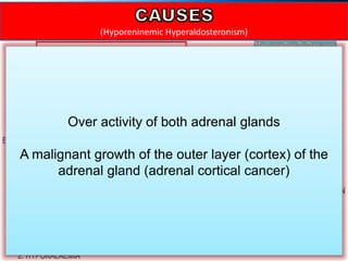 (Hyporeninemic Hyperaldosteronism)
Over activity of both adrenal glands
A malignant growth of the outer layer (cortex) of the
adrenal gland (adrenal cortical cancer)
 