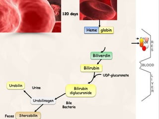HemoglobinHeme globin
120 days
Biliverdin
Bilirubin
Bilirubin
diglucuronide
Urobilinogen
Urobilin
Stercobilin
UDP-glucuronate
Urine
Bile
Bacteria
Feces
 