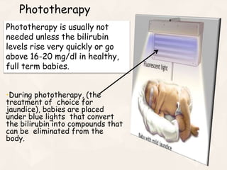 Phototherapy
•During phototherapy, (the
treatment of choice for
jaundice), babies are placed
under blue lights that convert
the bilirubin into compounds that
can be eliminated from the
body.
Phototherapy is usually not
needed unless the bilirubin
levels rise very quickly or go
above 16-20 mg/dl in healthy,
full term babies.
 