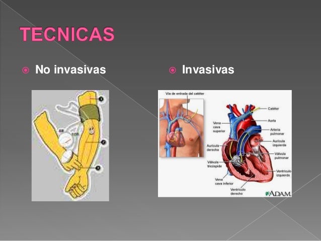 Monitoreo hemodinámico no invasivo e invasivo CICATSALUD