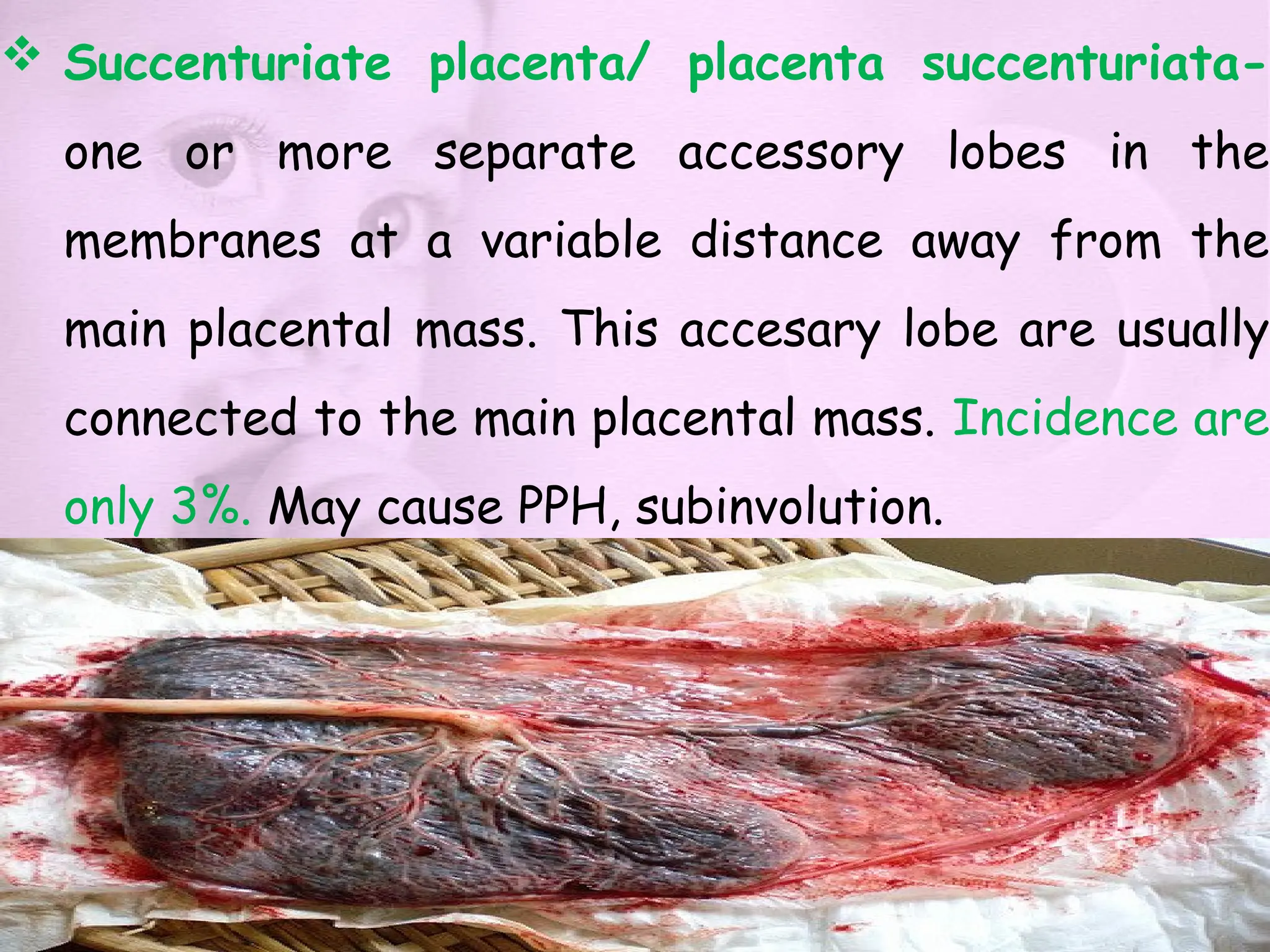  Succenturiate placenta/ placenta succenturiata-
one or more separate accessory lobes in the
membranes at a variable distance away from the
main placental mass. This accesary lobe are usually
connected to the main placental mass. Incidence are
only 3%. May cause PPH, subinvolution.
 