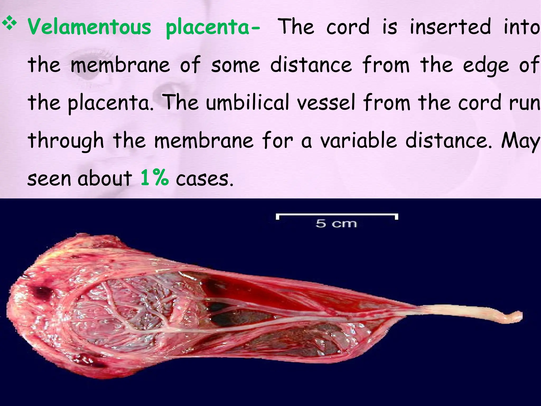  Velamentous placenta- The cord is inserted into
the membrane of some distance from the edge of
the placenta. The umbilical vessel from the cord run
through the membrane for a variable distance. May
seen about 1% cases.
 