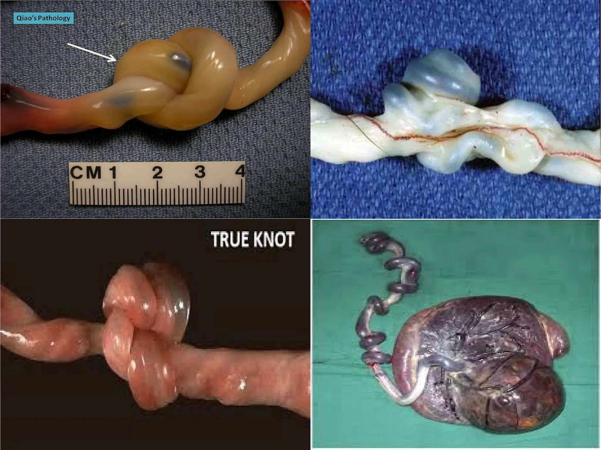 501340725-Unit-2-Fertilization-impantation-development-of-placenta-and-its-function-abnormality.pptx