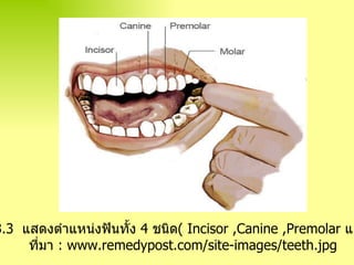 ภาพ ที่   3 . 3  แสดงตำแหน่งฟันทั้ง  4   ชนิด (  Incisor   ,Canine ,Premolar   และ  Molar ) ที่มา  : www.remedypost.com/site-images/teeth.jpg 