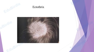 50247-cutaneous-mycoses of musculoskeletal | PDF