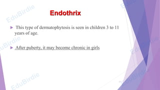 50247-cutaneous-mycoses of musculoskeletal | PDF