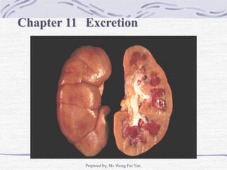 Prepared by, Ms Wong Fui Yen
Chapter 11 Excretion
 